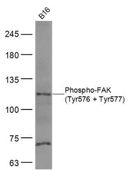 Phospho-FAK (Tyr576 + Tyr577) Rabbit Polyclonal Antibody