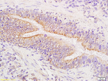 Phospho-FAK (Tyr576 + Tyr577) Rabbit Polyclonal Antibody