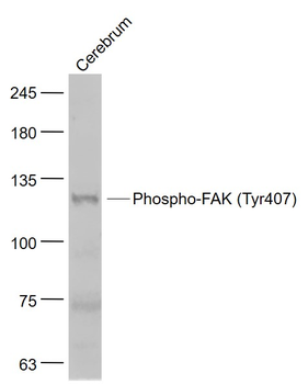 Phospho-FAK (Tyr407) Rabbit Polyclonal Antibody