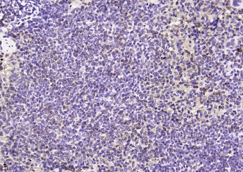 Phospho-FAK (Ser722) Rabbit Polyclonal Antibody