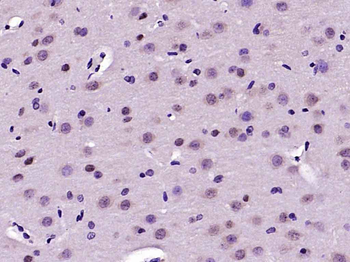 Phospho-FAK (Tyr925) Rabbit Polyclonal Antibody