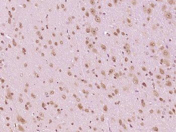 Phospho-FAK (Tyr925) Rabbit Polyclonal Antibody