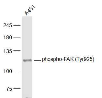 Phospho-FAK (Tyr925) Rabbit Polyclonal Antibody