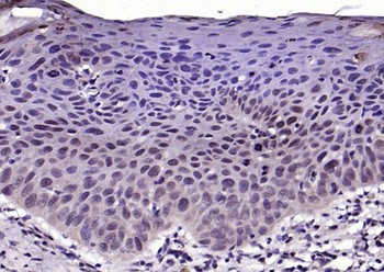 Phospho-FGFR1 (Tyr653 + Tyr654) Rabbit Polyclonal Antibody