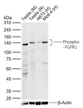 Phospho-FGFR1 (Tyr653 + Tyr654) Rabbit Polyclonal Antibody