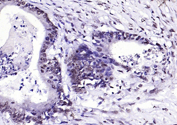 Phospho-FGFR1 (Tyr307) Rabbit Polyclonal Antibody
