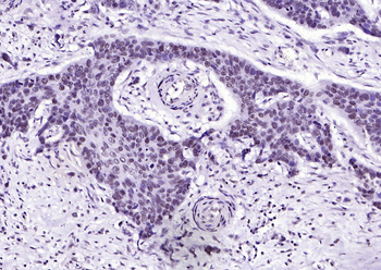 Phospho-FGFR1 (Tyr307) Rabbit Polyclonal Antibody