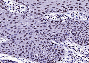 Phospho-FGFR1 (Tyr307) Rabbit Polyclonal Antibody