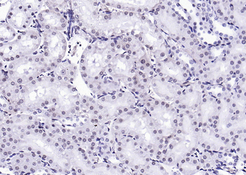 Phospho-FGFR1 (Tyr307) Rabbit Polyclonal Antibody