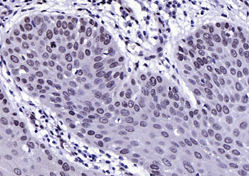 Phospho-FGFR1+FGFR2 (Tyr463/Tyr466) Rabbit Polyclonal Antibody