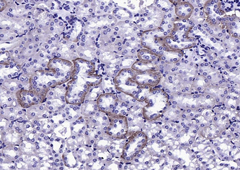 Phospho-FGFR1+FGFR2 (Tyr463/Tyr466) Rabbit Polyclonal Antibody