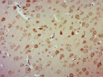 FLASH Rabbit Polyclonal Antibody