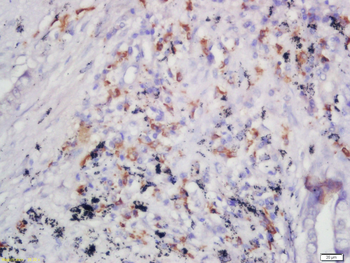 Phospho-FLT3 (Tyr589 + Tyr591) Rabbit Polyclonal Antibody