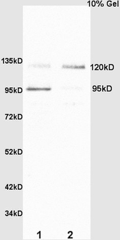 CD133 Rabbit Polyclonal Antibody