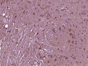 Nidogen Rabbit Polyclonal Antibody