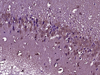 Nidogen Rabbit Polyclonal Antibody