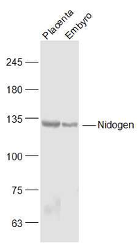 Nidogen Rabbit Polyclonal Antibody
