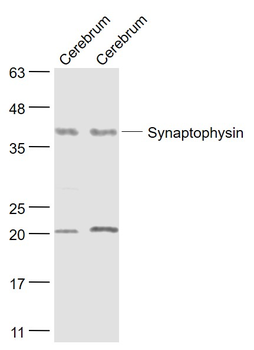 Synaptophysin Rabbit Polyclonal Antibody