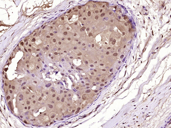 Caspase-2 p13 Rabbit Polyclonal Antibody