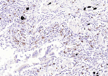 Caspase-2 p13 Rabbit Polyclonal Antibody