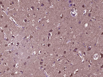Galectin 3 Mouse Monoclonal Antibody