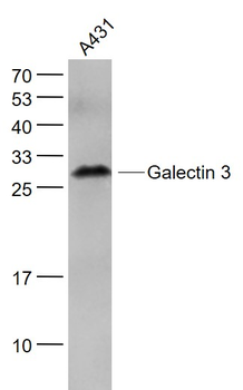 Galectin 3 Mouse Monoclonal Antibody