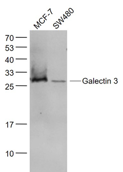 Galectin 3 Mouse Monoclonal Antibody