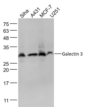 Galectin 3 Mouse Monoclonal Antibody