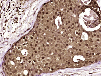 Peroxiredoxin-6 Rabbit Polyclonal Antibody