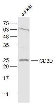 CD3D Rabbit Polyclonal Antibody