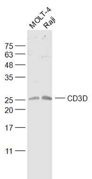 CD3D Rabbit Polyclonal Antibody