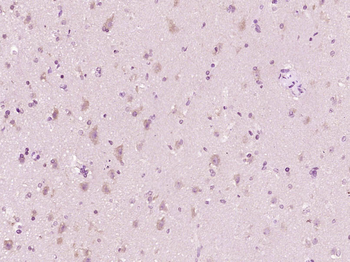 Caspase-10 Rabbit Polyclonal Antibody