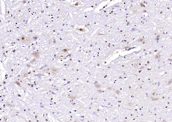 PKC delta Rabbit Polyclonal Antibody
