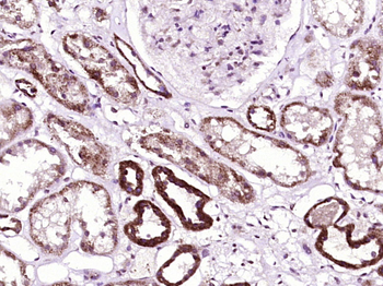 SOCS1 Rabbit Polyclonal Antibody