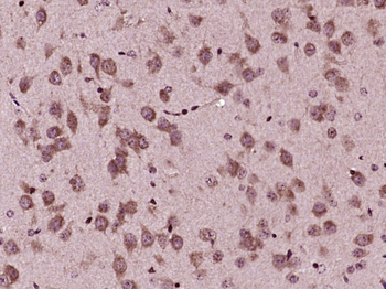 SOCS1 Rabbit Polyclonal Antibody