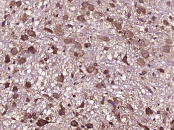 VDAC Rabbit Polyclonal Antibody