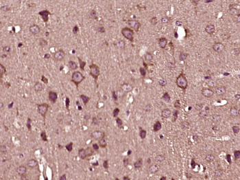 TAK1/MAP3K7 Rabbit Polyclonal Antibody