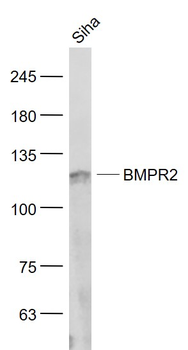 BMPR2 Rabbit Polyclonal Antibody