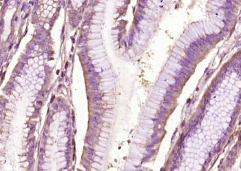 Patched Rabbit Polyclonal Antibody
