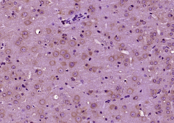 Patched Rabbit Polyclonal Antibody