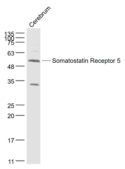 Somatostatin Receptor 5 Rabbit Polyclonal Antibody