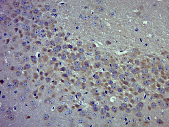 Ezrin/Radixin Rabbit Polyclonal Antibody