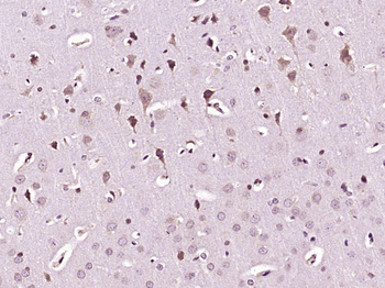 Phospho-APG4B (Ser34) Rabbit Polyclonal Antibody