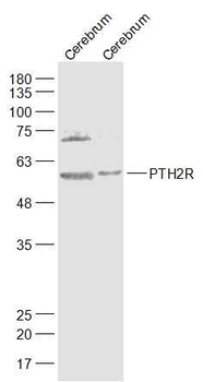 PTH2R Rabbit Polyclonal Antibody