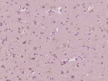 IFNB1 Rabbit Polyclonal Antibody
