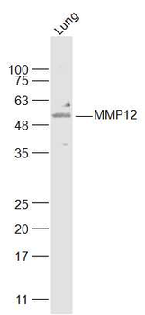 MMP12 Rabbit Polyclonal Antibody