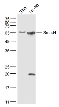 Smad4 Rabbit Polyclonal Antibody