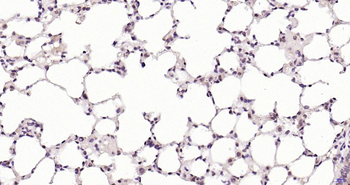 Smad4 Rabbit Polyclonal Antibody