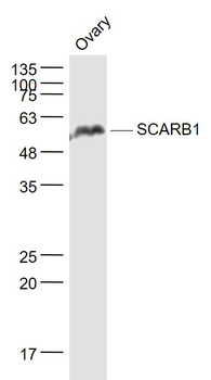 SCARB1/Scavenger Receptor BI Rabbit Polyclonal Antibody