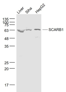 SCARB1/Scavenger Receptor BI Rabbit Polyclonal Antibody